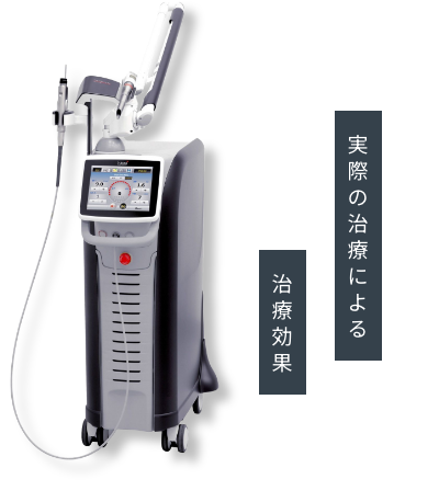 実際の治療による治療効果