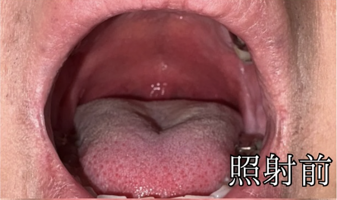 治療前