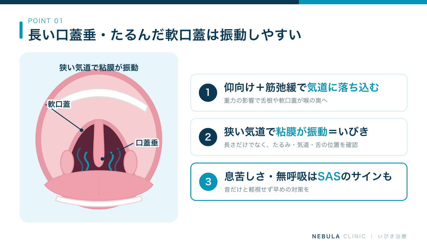 のどちんこ（口蓋垂）が長いといびきをかく理由（口を開けた喉の奥の正面図で、垂れ下がった口蓋垂と軟口蓋が狭い気道で振動する様子、仰向けで重力と筋弛緩により落ち込む・狭い気道を空気が勢いよく通過・窒息感や睡眠時無呼吸症候群のサインにも）の図解