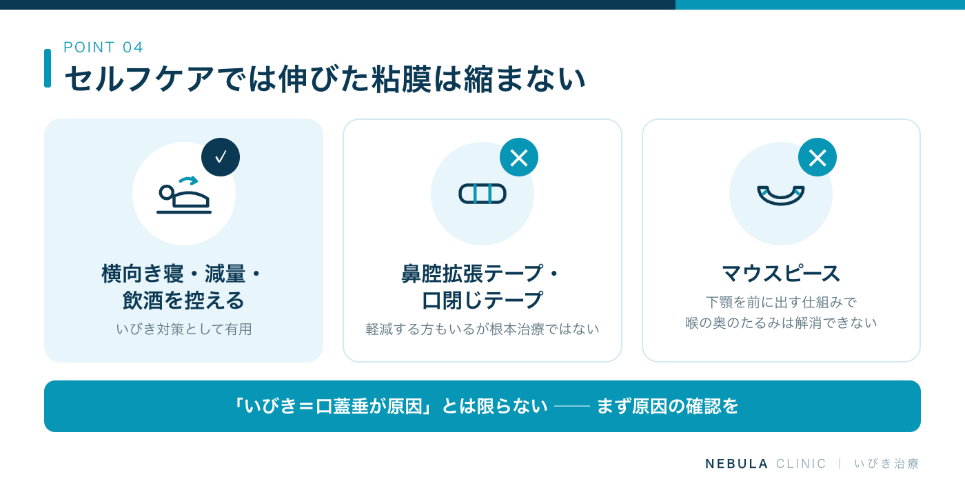 セルフケアやグッズで口蓋垂のたるみは治るか（横向き寝・減量・就寝前の飲酒を控える・鼻腔拡張テープや口閉じテープはいびき対策として有用な場合があるが、伸びた軟口蓋や口蓋垂を自力で縮めることは困難で根本治療ではない）の図解