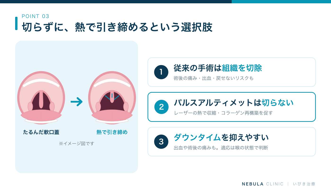 長いのどちんこを治す治療法の比較（従来の口蓋垂切除術はメスで切り取るため術後の痛みや出血リスクがある、切らないレーザー治療パルスアルティメットは熱エネルギーで軟口蓋などを引き締め出血や痛み・ダウンタイムを抑えやすい）の図解